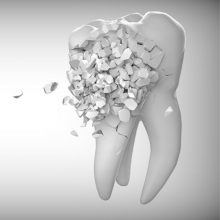 Dişleri Güçlendiren Besinler Nelerdir?